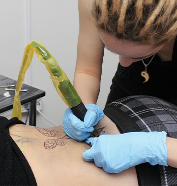 What Happens After A Laser Tattoo Removal?